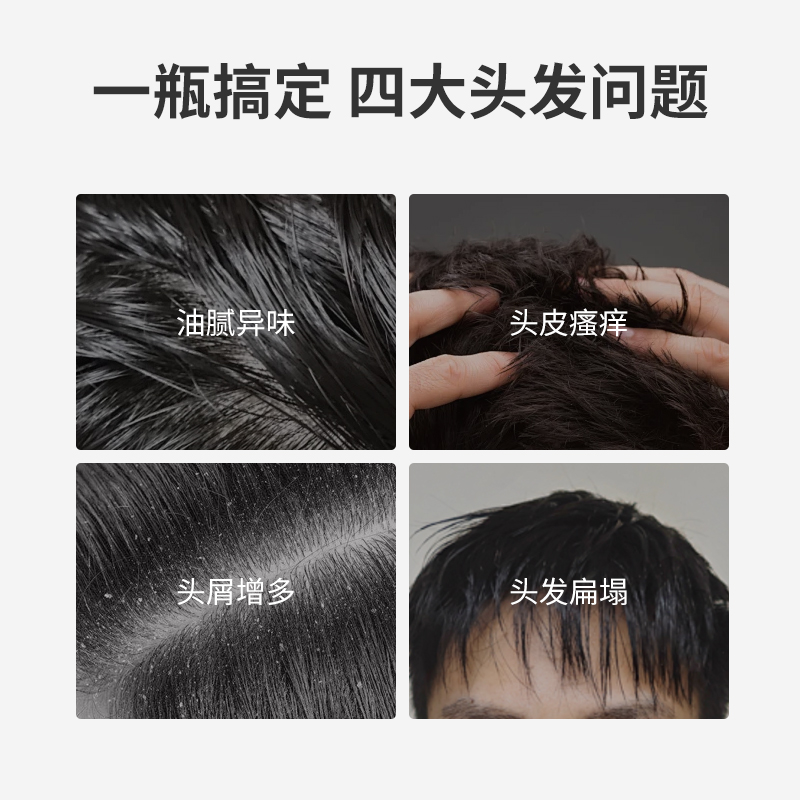 一瓶搞定四大頭發(fā)問(wèn)題