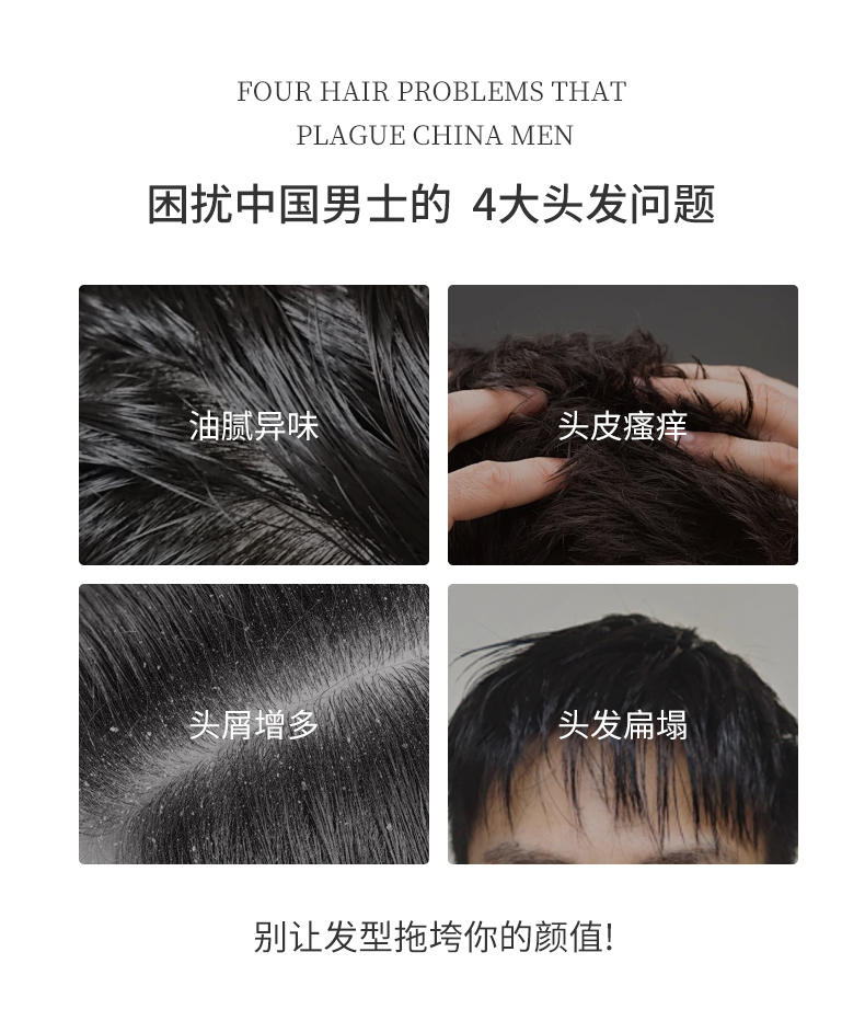困擾中國(guó)男士的四大問(wèn)題，油膩異味、頭皮瘙癢、頭屑增多、頭發(fā)扁塌